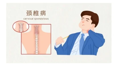 O nesanici? Da li ste razmatrali uzrok vratne kičme?